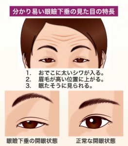 目１